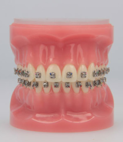Empower® Self Ligating Brackets