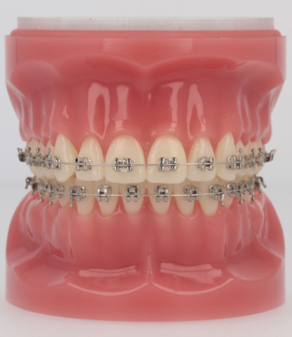 Master Series Brackets with Iconix Wire
