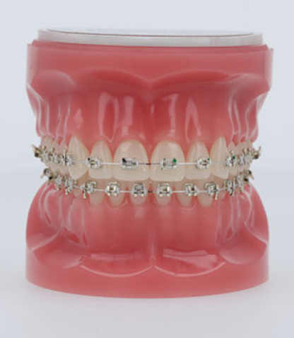 Iconix Bracket